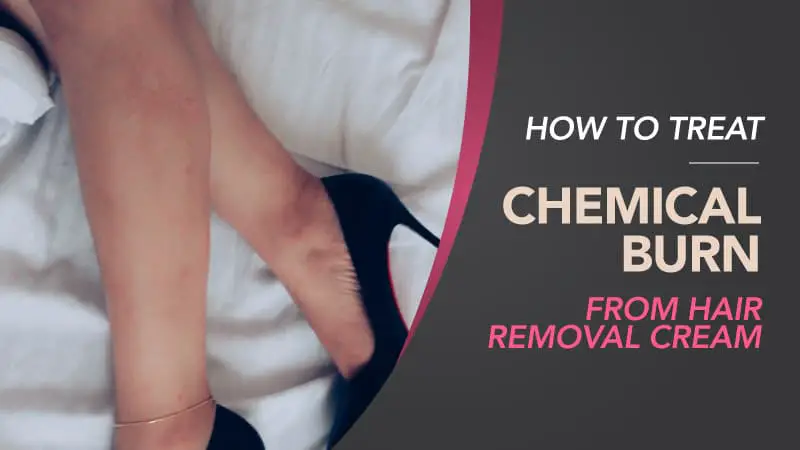 How-To-Treat-Chemical-Burn-From-Hair-Removal-Cream